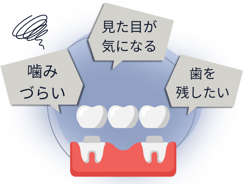 ブリッジのイラスト