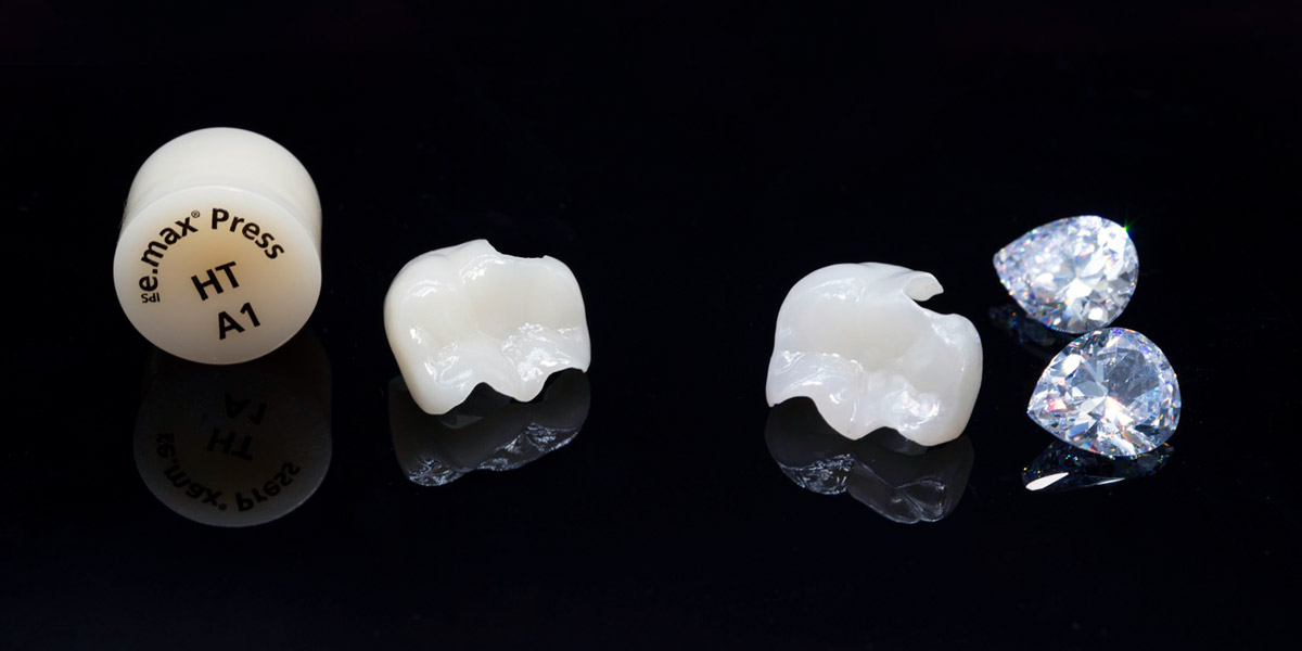 e-maxインレーイメージ