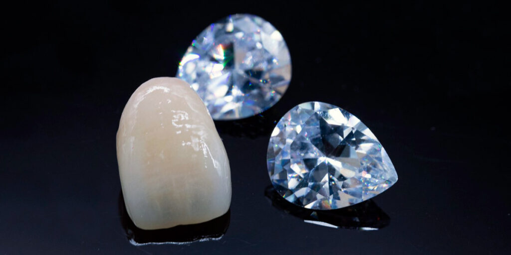 ラミネートベニアイメージ